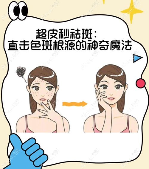 激光祛斑价目表