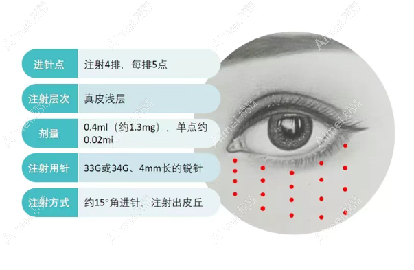 注射薇旖美胶原蛋白水光避坑指南
