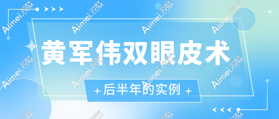 黄军伟双眼皮术后半年的实例