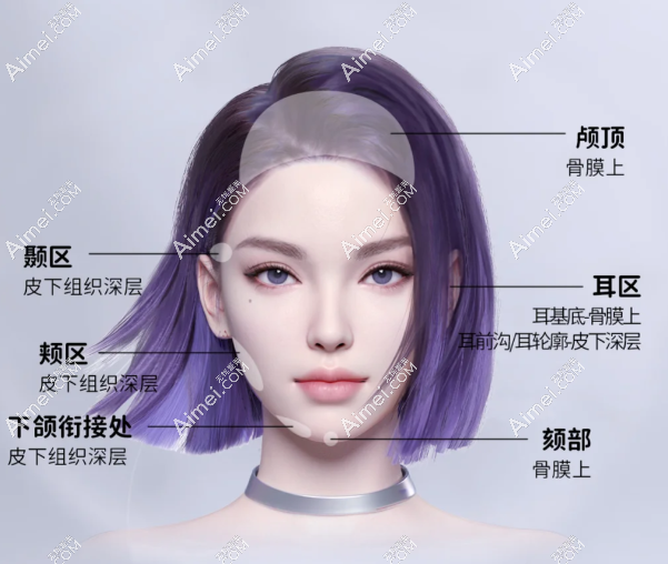 瑞娅玻尿酸适合打那个部位