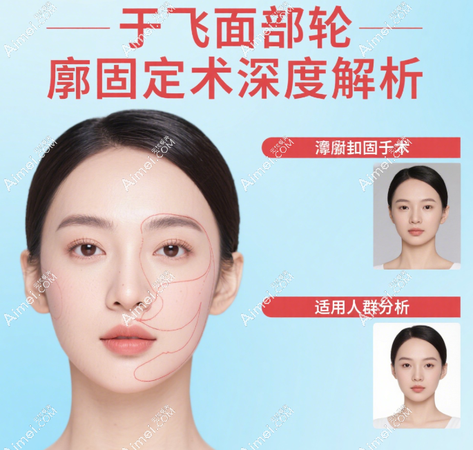 于飞医生的面部轮廓固定到底适合谁