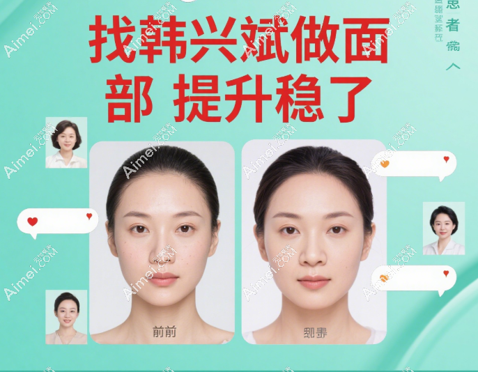 韩兴斌医生面部提升