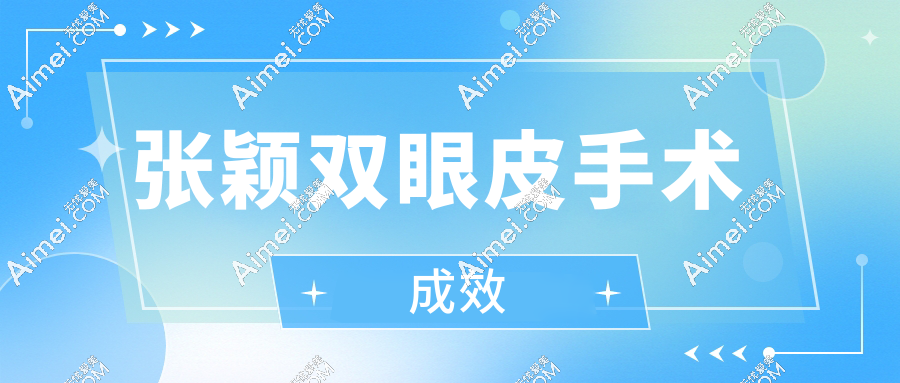 张颖双眼皮手术成效