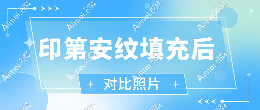 印第安纹填充后对比照片