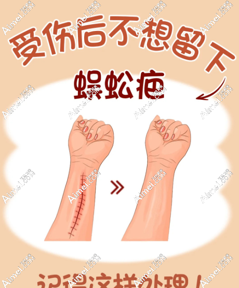 2025国内做超减张缝合术祛疤正规靠谱的医院排名前十(这10家医院术后疤痕薄如发丝,便宜技术好) 