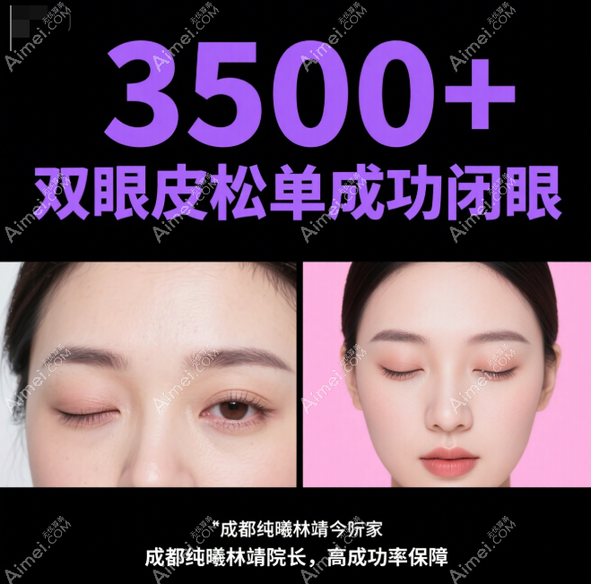 成都纯曦林靖双眼皮修复技术好