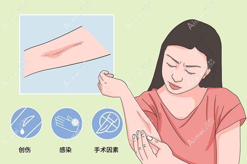 昆明祛疤痕正规医院排名前十推荐：昆明昆大 | 吴氏嘉美等 10 家疤痕修复正规医院上榜（含价格表）