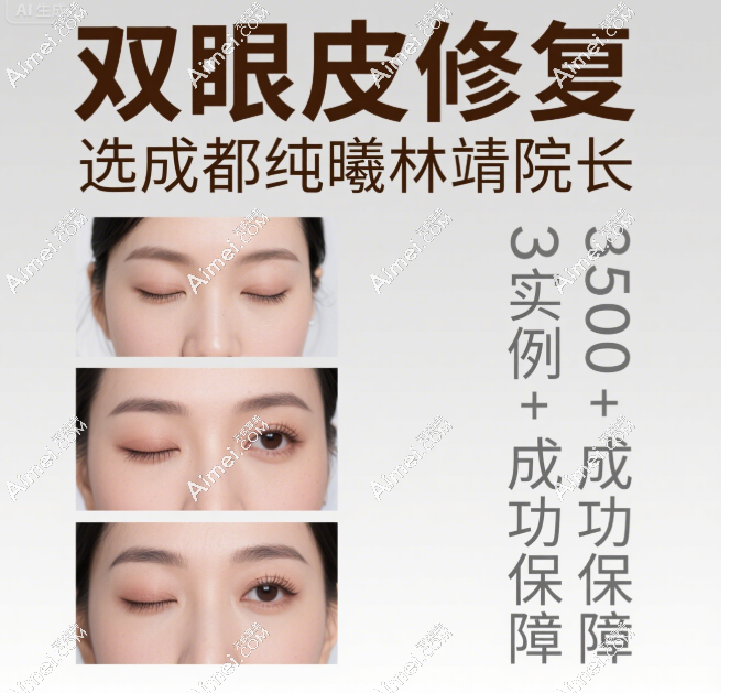 成都纯曦林靖双眼皮修复实例