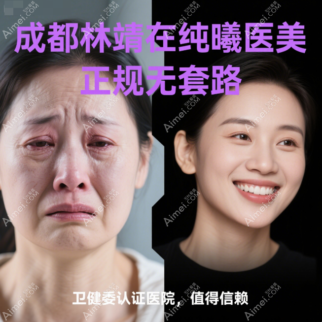成都纯曦林靖双眼修复做得好 成都纯曦林靖双眼修复做得好