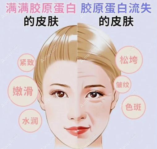 面部去皱