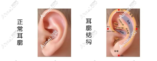 北京协和医院做耳再造术后费用