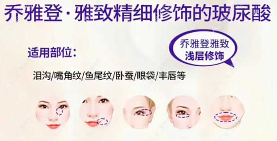 打玻尿酸针垫唇型