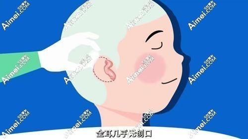怎么才能挂上协和的号
