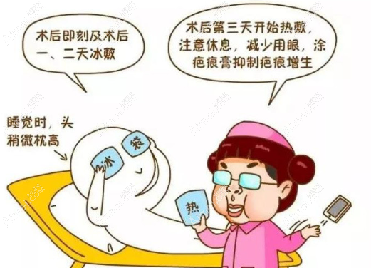 双眼皮 双眼皮
