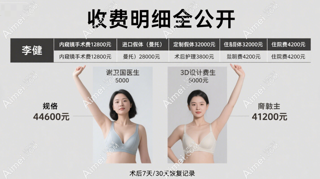 上海华美李健和谢卫国隆胸收费明细对比 上海华美李健和谢卫国隆胸收费明细对比