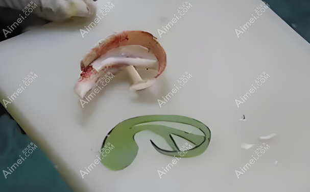 北京八大处整形医院小耳畸形手术医生排名推荐