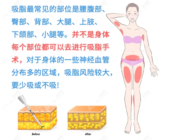 北京减肥哪个医院正规好排名榜：八大处/玉之光等10家实力口碑减肥医院推荐