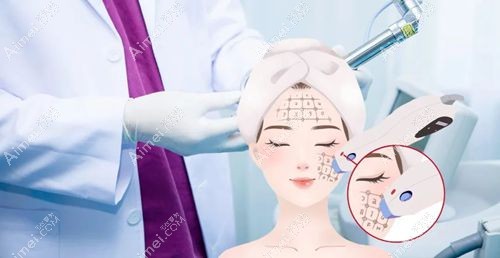 40+做热玛吉你的皮肤达标了吗 40+做热玛吉你的皮肤达标了吗