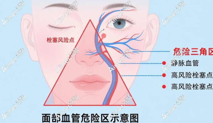 危险三角区