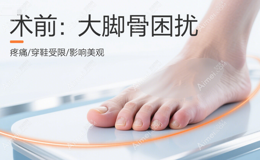 马桂文术科大脚骨手术恢病例对比照，光导复位技术让脚型自然美观