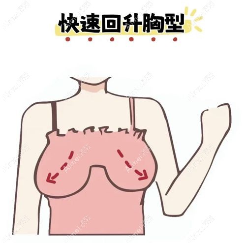 产后胸部下垂矫正多少钱？2万起！做胸部提升手术真实成效分享，松弛变紧致！