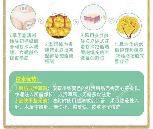 重庆脂肪丰胸出名的医院前十选择建议