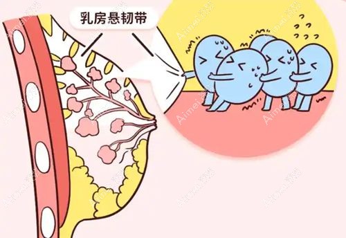 产后胸部下垂矫正多少钱