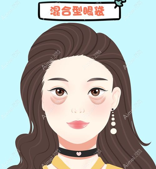 眼袋泪沟显疲惫怎么改善