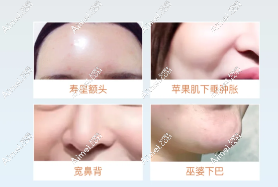 上海郭健馒化修复医生患者评价