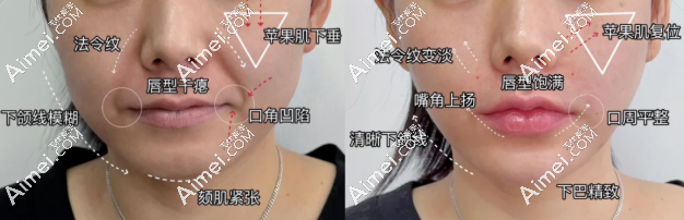 上海郭健馒化修复价格