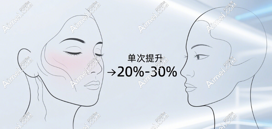 热玛吉做一次紧致提升20%-30% 热玛吉做一次紧致提升20%-30%