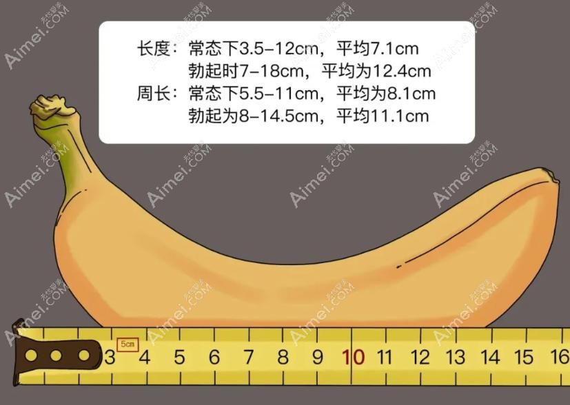 张国喜医生做阴茎假体植入在国内很出名，全国男科医生排名前五实力解析