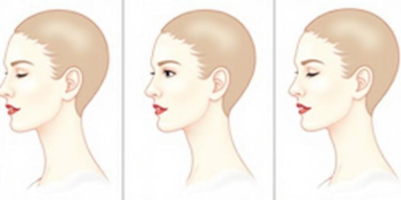 做过的人都说好：5位姐妹共同推荐的八大处面部二次修复医生——靳小雷/李洁/于晓波