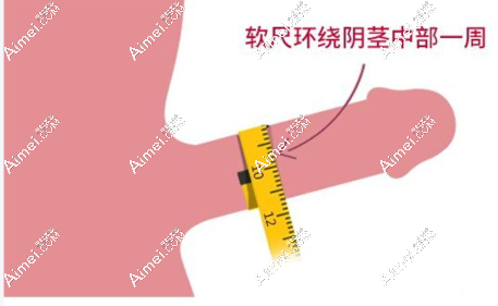 王文卫做增粗手术3万起，包含术前检查/复诊等，性价比高成效赞