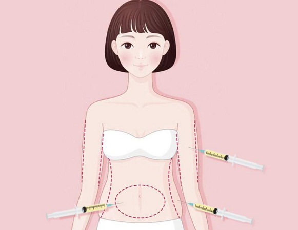 王娜医生吸脂价格与项目对照