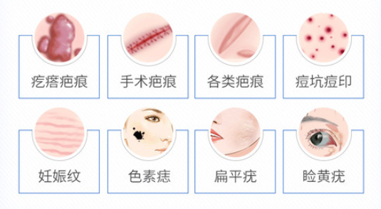 北京八大处治疗疤痕疙瘩多少钱
