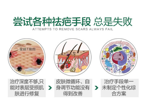 王连召做疤痕切缝怎么样