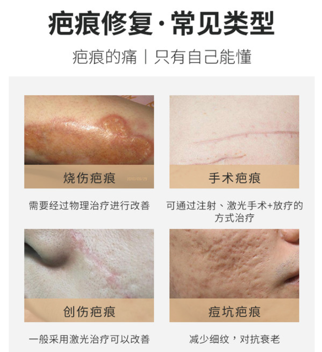 王连召祛陈旧性疤痕技术好吗
