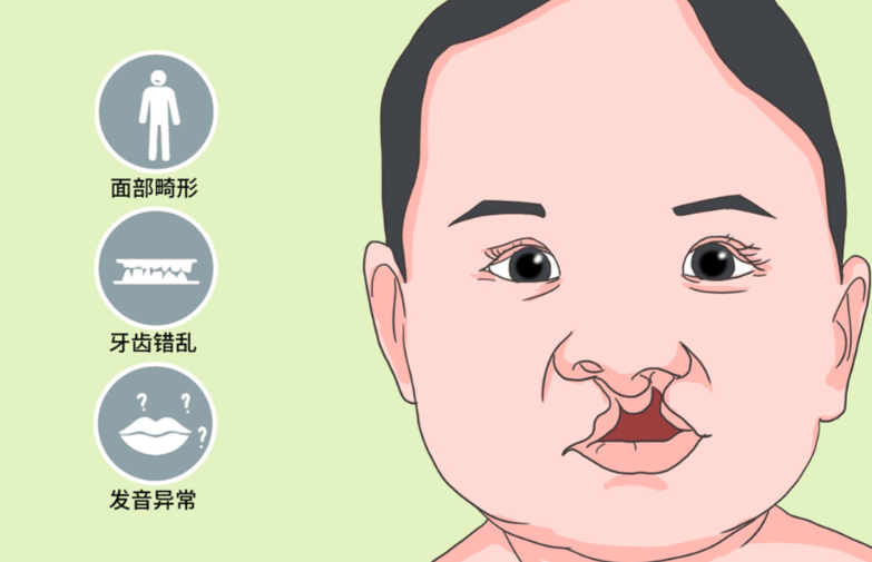 毛喆医生在哪家医院坐诊？坐诊广州妇女儿童医疗中心口腔颌面外科，唇腭裂修复口碑好