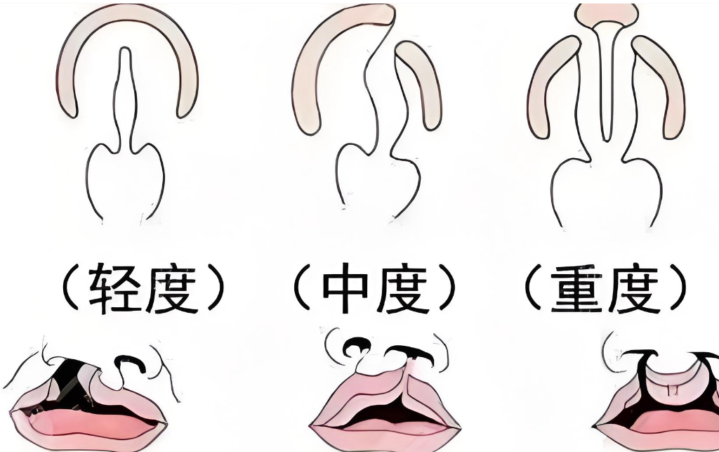 广州妇女儿童医疗中心口腔颌面外科部分项目的价格