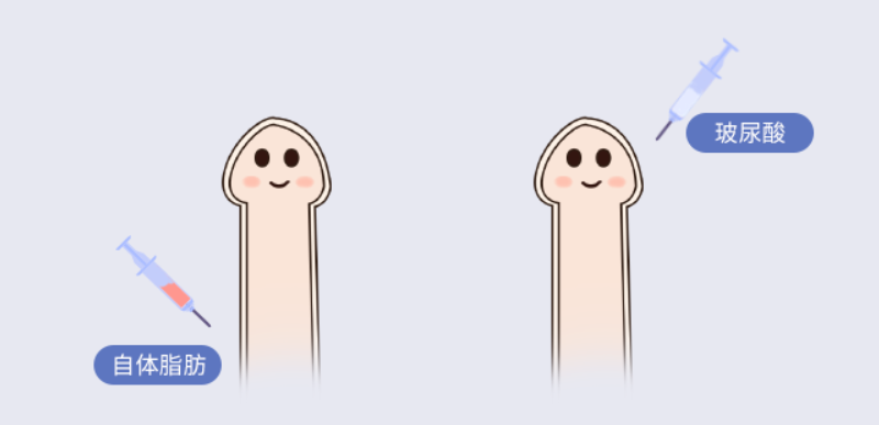 程开祥的手术是在哪家医院做的?上海这2家私立机构能约!主打男性私密增粗延长修复