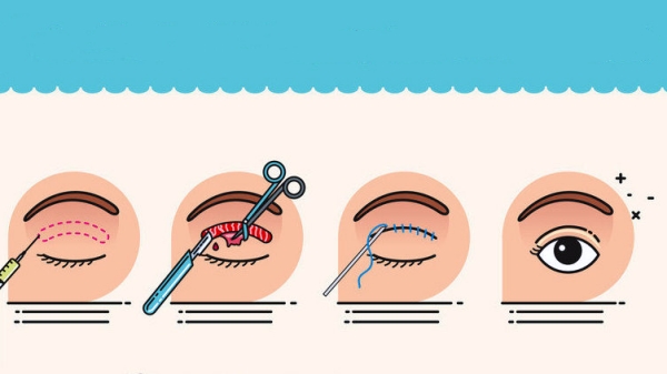 合肥曹林和上海郑小红双眼皮修复哪个好？曹林审美佳，郑小红价格优，按需选