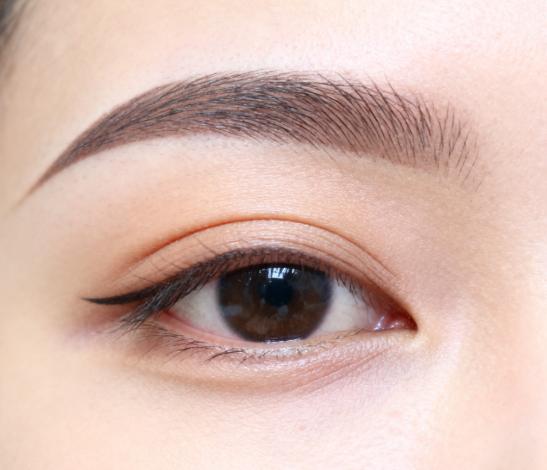 杜园园口碑为什么稳定?眼修复实例覆盖双眼皮/外眼角/下睑外翻,每例都有用户反馈