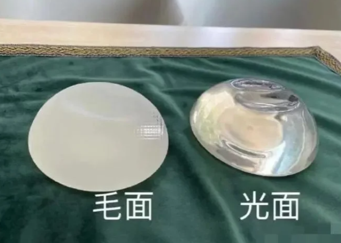 广州美莱医疗美容丰胸价格表来了!假体1.8w起脂肪2.6w起,附植发祛斑除皱费用