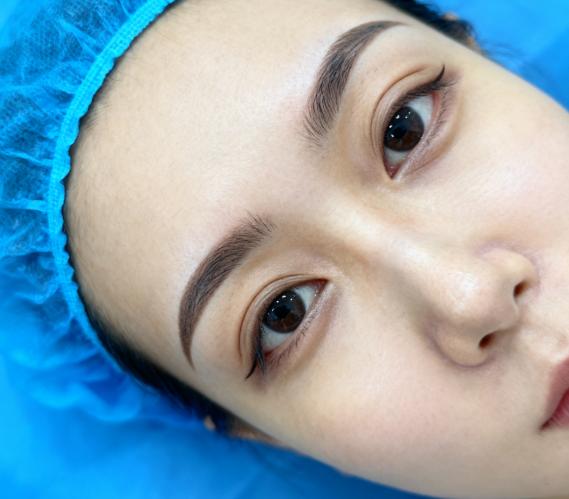 杜园园和其他做眼修复的医生在高难度失败眼修复的“形态重建”上的不同