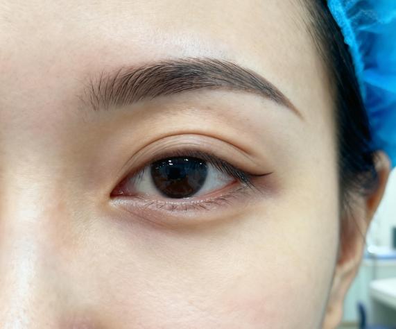 杜园园和其他做眼修复的医生在高难度失败眼修复的“价格透明性”上的不同