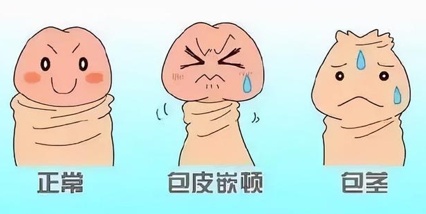 王文卫延长术优势