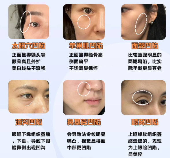 王浩:脂肪丰胸“大拿”,手感自然到像天生