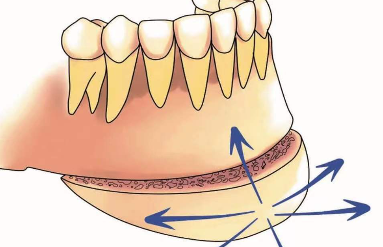 周会喜的号怎么抢?美恩整形可付费预约抢号-正颌手术价格8-12万起