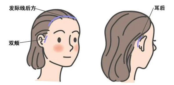 穆宝安面部提升会亲自做手术吗？30年泰斗亲操，V美减龄技术早20年